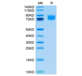 Tris-Bis PAGE - Recombinant Human CD166 Protein (Biotin) (C-terminal His Tag) (A330248) - Antibodies.com