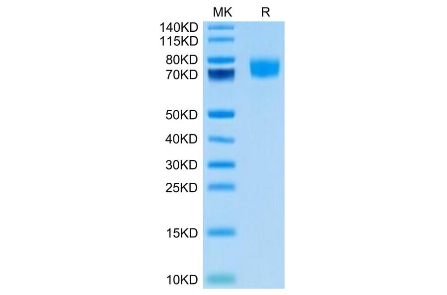 Tris-Bis PAGE - Recombinant Human CD166 Protein (Biotin) (C-terminal His Tag) (A330248) - Antibodies.com
