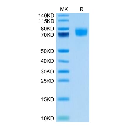 Tris-Bis PAGE - Recombinant Human CD166 Protein (Biotin) (C-terminal His Tag) (A330248) - Antibodies.com