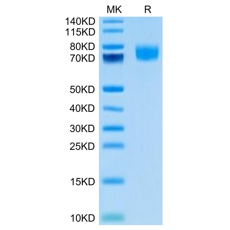 Tris-Bis PAGE - Recombinant Human CD166 Protein (Biotin) (C-terminal His Tag) (A330248) - Antibodies.com