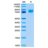 Tris-Bis PAGE - Recombinant Human CD166 Protein (Biotin) (C-terminal His Tag) (A330248) - Antibodies.com