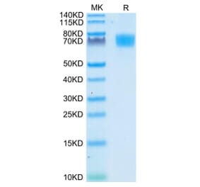 Tris-Bis PAGE - Recombinant Human CD166 Protein (C-terminal His Tag) (A330249) - Antibodies.com