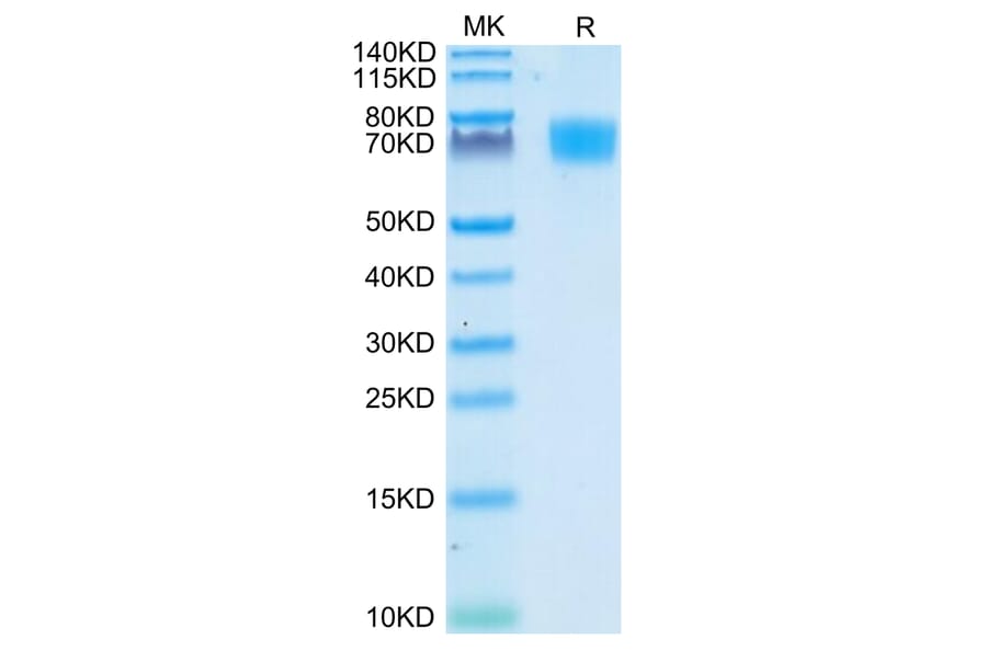Tris-Bis PAGE - Recombinant Human CD166 Protein (C-terminal His Tag) (A330249) - Antibodies.com