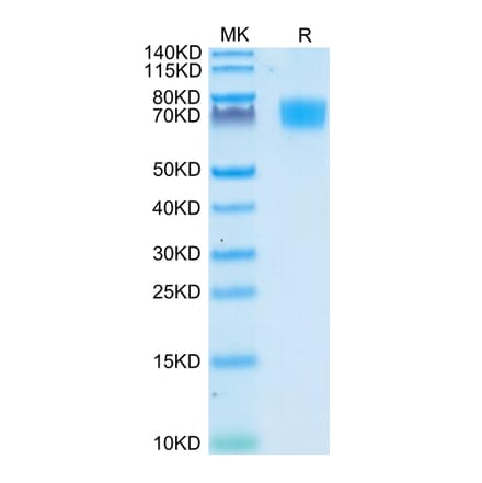 Tris-Bis PAGE - Recombinant Human CD166 Protein (C-terminal His Tag) (A330249) - Antibodies.com