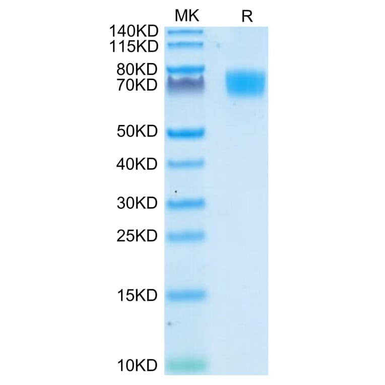 Tris-Bis PAGE - Recombinant Human CD166 Protein (C-terminal His Tag) (A330249) - Antibodies.com