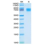 Tris-Bis PAGE - Recombinant Human CD166 Protein (C-terminal His Tag) (A330249) - Antibodies.com