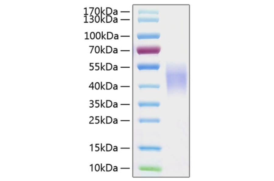 SDS-PAGE - Recombinant Human CD16b Protein (C-terminal His Tag) (A330250) - Antibodies.com