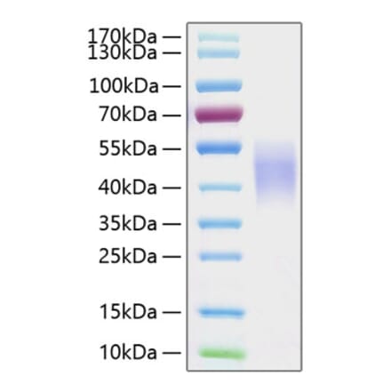 SDS-PAGE - Recombinant Human CD16b Protein (C-terminal His Tag) (A330250) - Antibodies.com