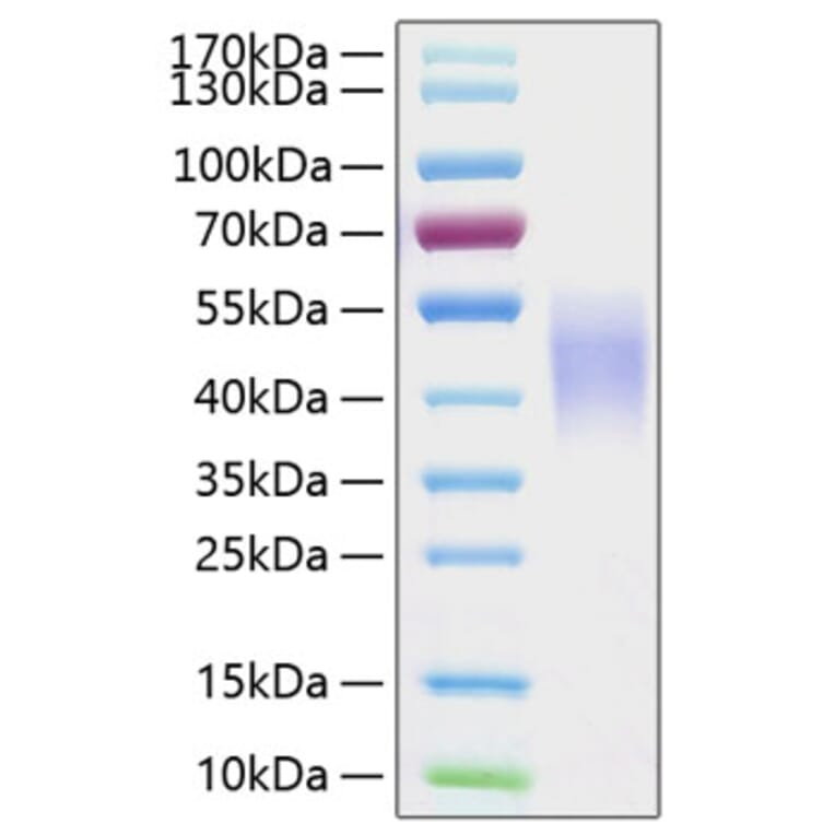 SDS-PAGE - Recombinant Human CD16b Protein (C-terminal His Tag) (A330250) - Antibodies.com