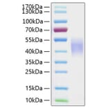 SDS-PAGE - Recombinant Human CD16b Protein (C-terminal His Tag) (A330250) - Antibodies.com