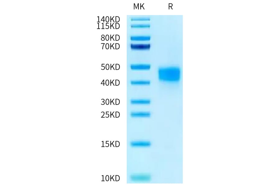 Tris-Bis PAGE - Recombinant Human CD16b Protein (C-terminal His Tag) (A330251) - Antibodies.com