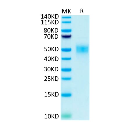 Tris-Bis PAGE - Recombinant Human CD16b Protein (Biotin) (C-terminal His and Avi Tag) (A330252) - Antibodies.com