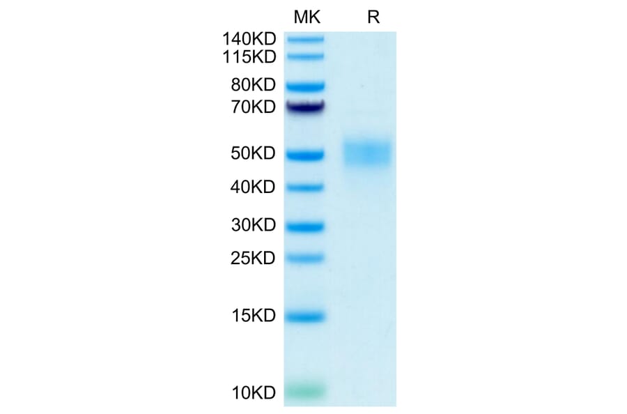 Tris-Bis PAGE - Recombinant Human CD16b Protein (C-terminal His and Avi Tag) (A330253) - Antibodies.com