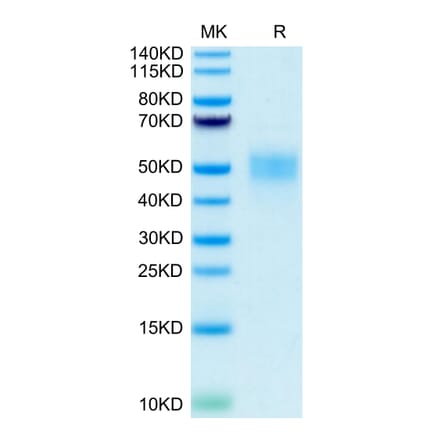 Tris-Bis PAGE - Recombinant Human CD16b Protein (C-terminal His and Avi Tag) (A330253) - Antibodies.com