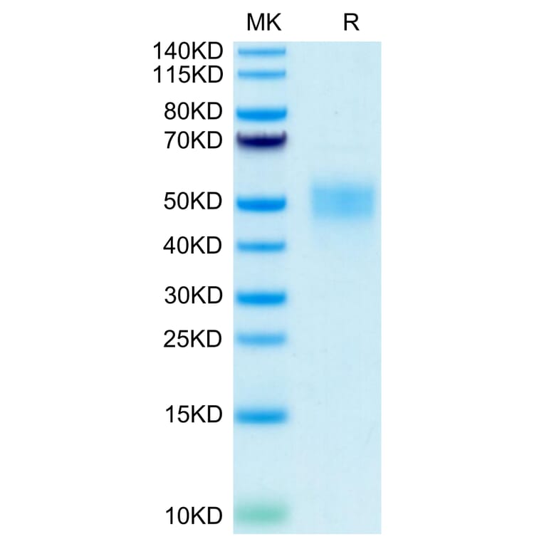 Tris-Bis PAGE - Recombinant Human CD16b Protein (C-terminal His and Avi Tag) (A330253) - Antibodies.com