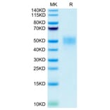 Tris-Bis PAGE - Recombinant Human CD16b Protein (C-terminal His and Avi Tag) (A330253) - Antibodies.com
