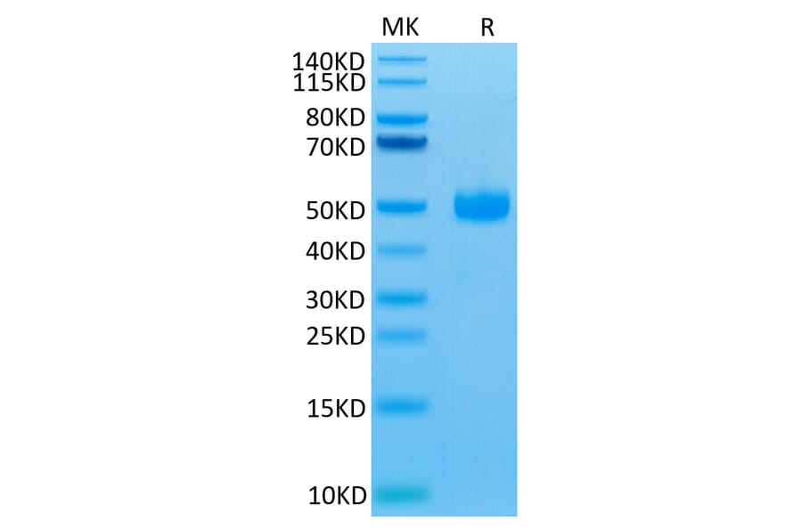 Tris-Bis PAGE - Recombinant Human CD172 gamma Protein (Biotin) (C-terminal His and Avi Tag) (A330254) - Antibodies.com