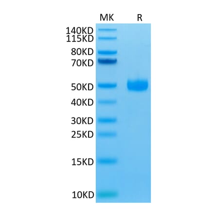 Tris-Bis PAGE - Recombinant Human CD172 gamma Protein (Biotin) (C-terminal His and Avi Tag) (A330254) - Antibodies.com