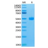 Tris-Bis PAGE - Recombinant Human CD172 gamma Protein (Biotin) (C-terminal His and Avi Tag) (A330254) - Antibodies.com