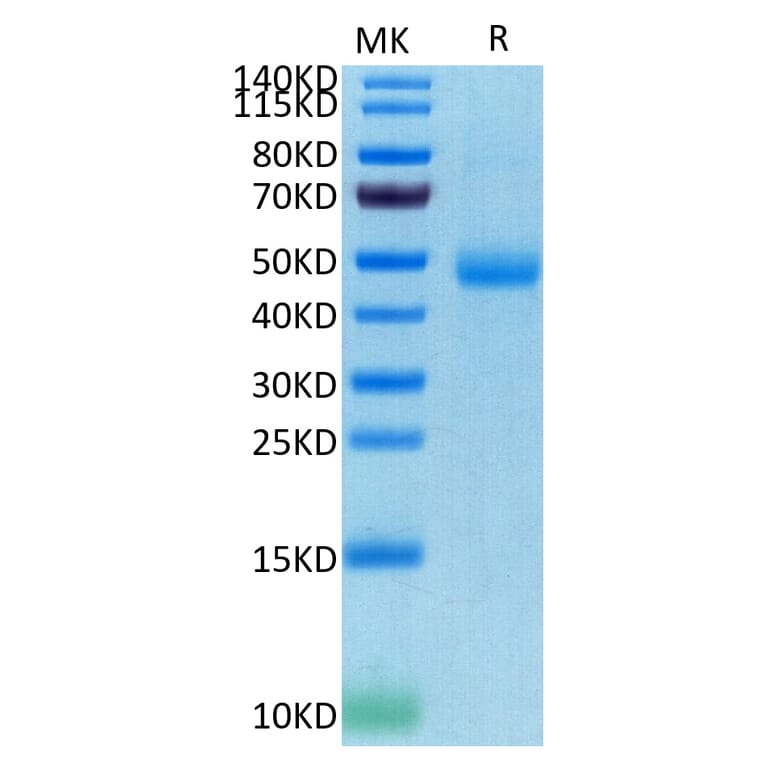 Tris-Bis PAGE - Recombinant Human CD172 gamma Protein (C-terminal His and Avi Tag) (A330255) - Antibodies.com