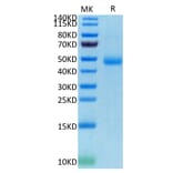 Tris-Bis PAGE - Recombinant Human CD172 gamma Protein (C-terminal His and Avi Tag) (A330255) - Antibodies.com