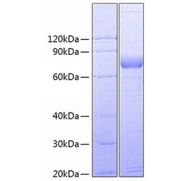 SDS-PAGE - Recombinant Human CD172 gamma Protein (C-terminal Fc Tag) (A330256) - Antibodies.com