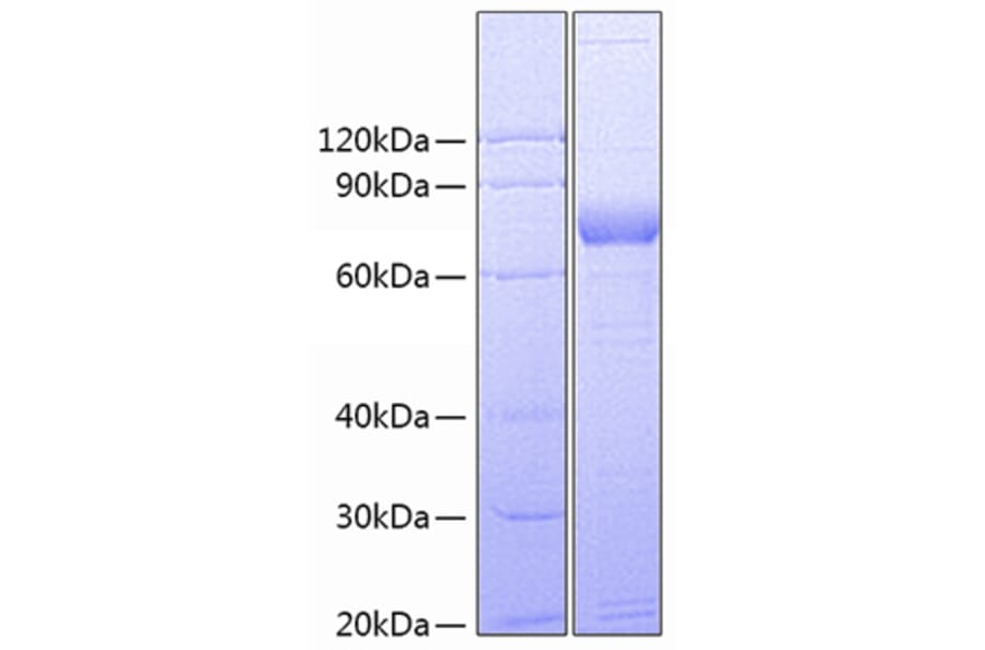 SDS-PAGE - Recombinant Human CD172 gamma Protein (C-terminal Fc Tag) (A330256) - Antibodies.com