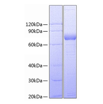 SDS-PAGE - Recombinant Human CD172 gamma Protein (C-terminal Fc Tag) (A330256) - Antibodies.com