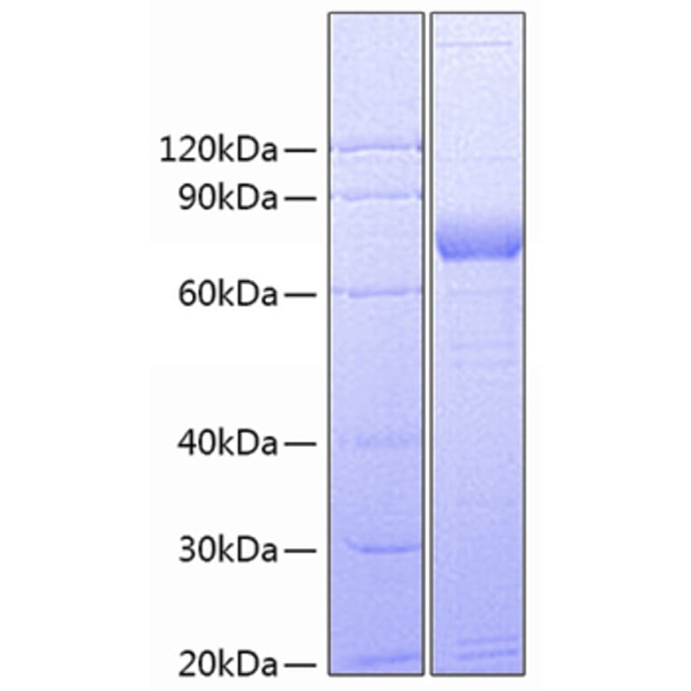 SDS-PAGE - Recombinant Human CD172 gamma Protein (C-terminal Fc Tag) (A330256) - Antibodies.com