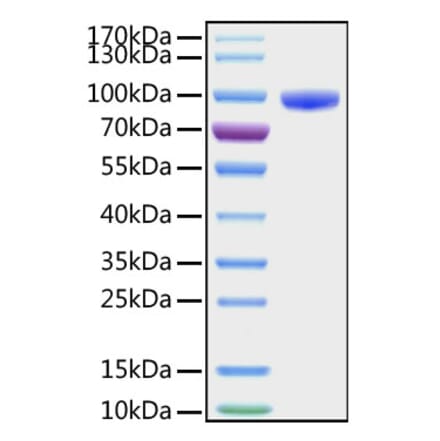 SDS-PAGE - Recombinant Human CD177 Protein (C-terminal Human Fc and His Tag) (A330257) - Antibodies.com