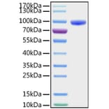 SDS-PAGE - Recombinant Human CD177 Protein (C-terminal Human Fc and His Tag) (A330257) - Antibodies.com