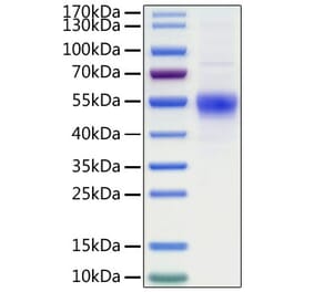 SDS-PAGE - Recombinant Human CD19 Protein (C-terminal His Tag) (A330258) - Antibodies.com