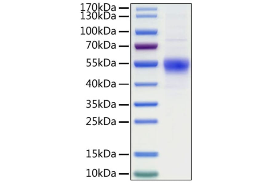 SDS-PAGE - Recombinant Human CD19 Protein (C-terminal His Tag) (A330258) - Antibodies.com