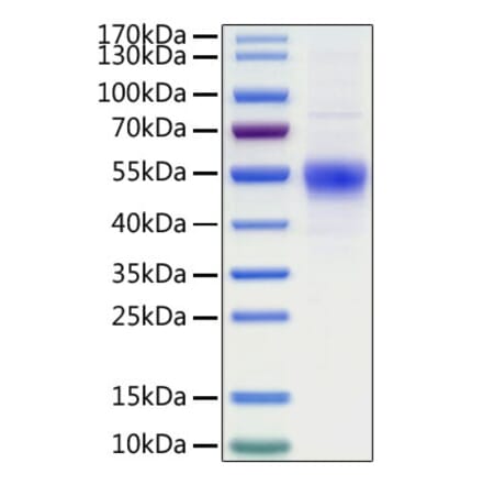 SDS-PAGE - Recombinant Human CD19 Protein (C-terminal His Tag) (A330258) - Antibodies.com