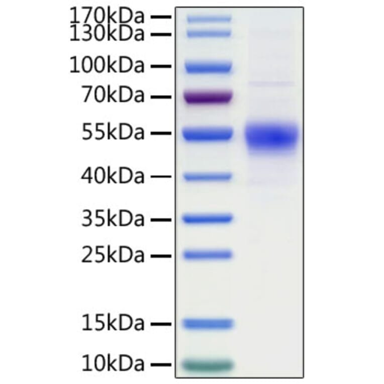 SDS-PAGE - Recombinant Human CD19 Protein (C-terminal His Tag) (A330258) - Antibodies.com