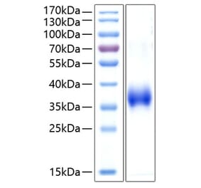 SDS-PAGE - Recombinant Human CD2 Protein (C-terminal His Tag) (A330259) - Antibodies.com