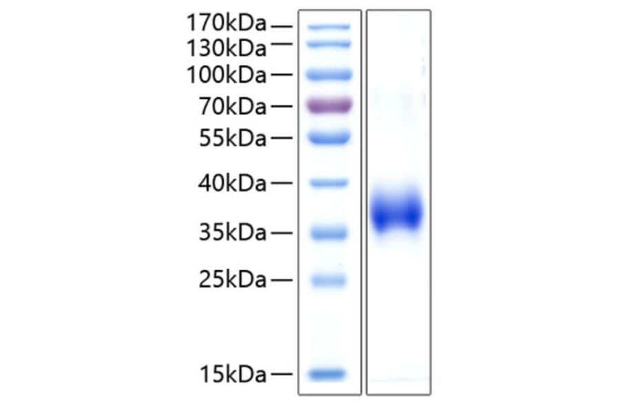 SDS-PAGE - Recombinant Human CD2 Protein (C-terminal His Tag) (A330259) - Antibodies.com