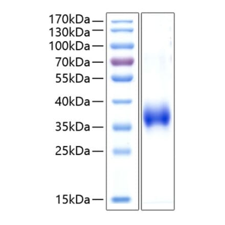 SDS-PAGE - Recombinant Human CD2 Protein (C-terminal His Tag) (A330259) - Antibodies.com