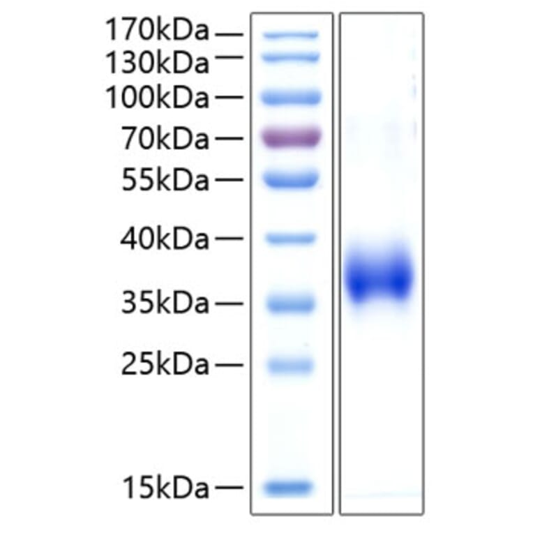SDS-PAGE - Recombinant Human CD2 Protein (C-terminal His Tag) (A330259) - Antibodies.com