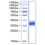 SDS-PAGE - Recombinant Human CD2 Protein (C-terminal His Tag) (A330259) - Antibodies.com