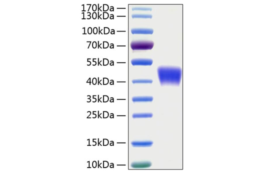 SDS-PAGE - Recombinant Human CD200 Protein (C-terminal His Tag) (A330261) - Antibodies.com