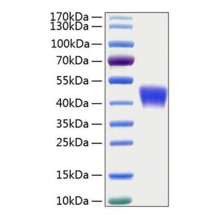 SDS-PAGE - Recombinant Human CD200 Protein (C-terminal His Tag) (A330261) - Antibodies.com