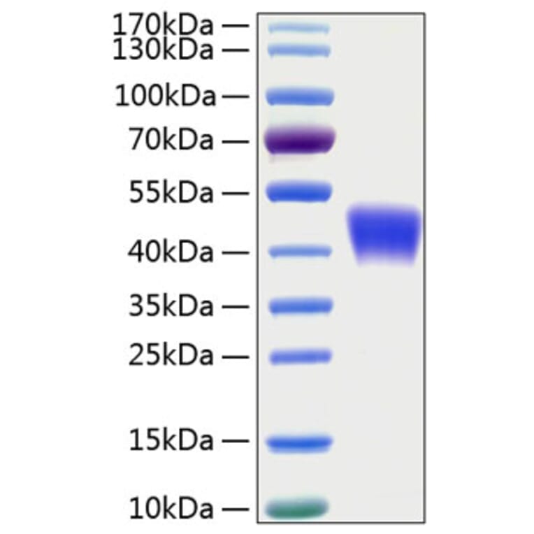 SDS-PAGE - Recombinant Human CD200 Protein (C-terminal His Tag) (A330261) - Antibodies.com