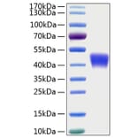 SDS-PAGE - Recombinant Human CD200 Protein (C-terminal His Tag) (A330261) - Antibodies.com