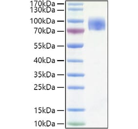 SDS-PAGE - Recombinant Human CD200R Protein (C-terminal Human Fc and His Tag) (A330262) - Antibodies.com