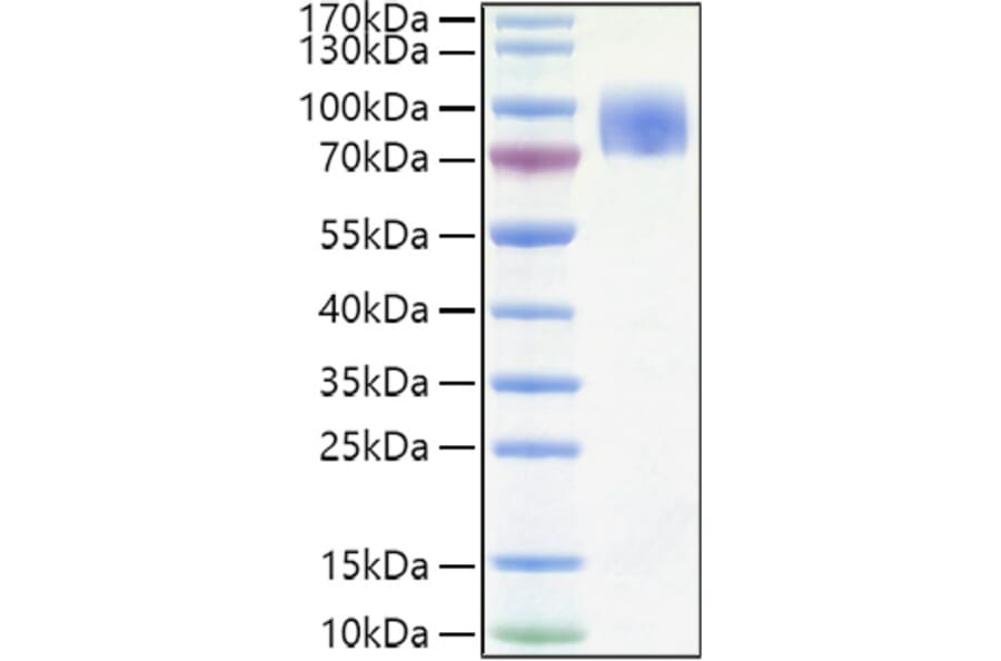 SDS-PAGE - Recombinant Human CD200R Protein (C-terminal Human Fc and His Tag) (A330262) - Antibodies.com
