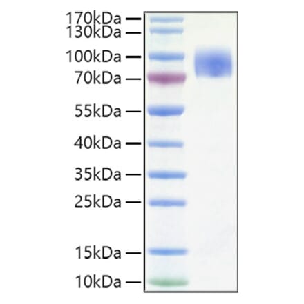 SDS-PAGE - Recombinant Human CD200R Protein (C-terminal Human Fc and His Tag) (A330262) - Antibodies.com
