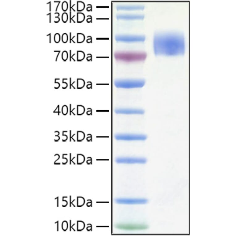 SDS-PAGE - Recombinant Human CD200R Protein (C-terminal Human Fc and His Tag) (A330262) - Antibodies.com