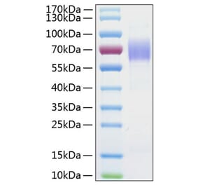 SDS-PAGE - Recombinant Human CD204 Protein (C-terminal His Tag) (A330263) - Antibodies.com