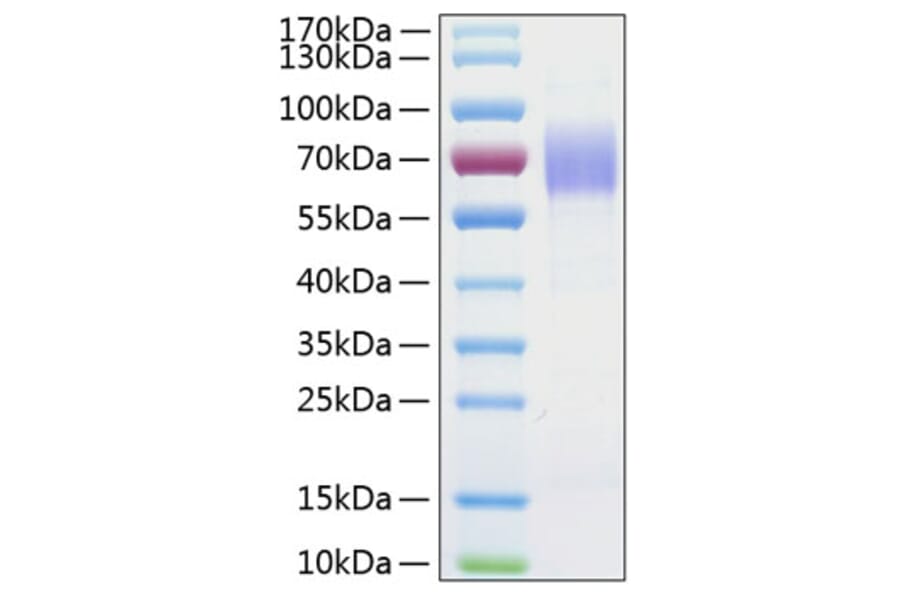 SDS-PAGE - Recombinant Human CD204 Protein (C-terminal His Tag) (A330263) - Antibodies.com